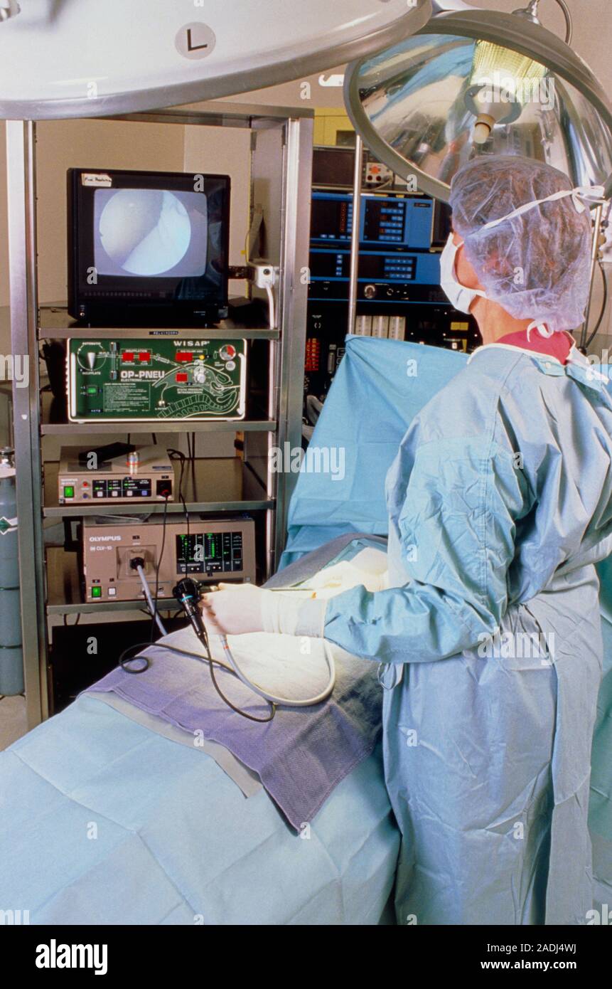 Cholecystectomy procedure. Surgeon removes the gallbladder