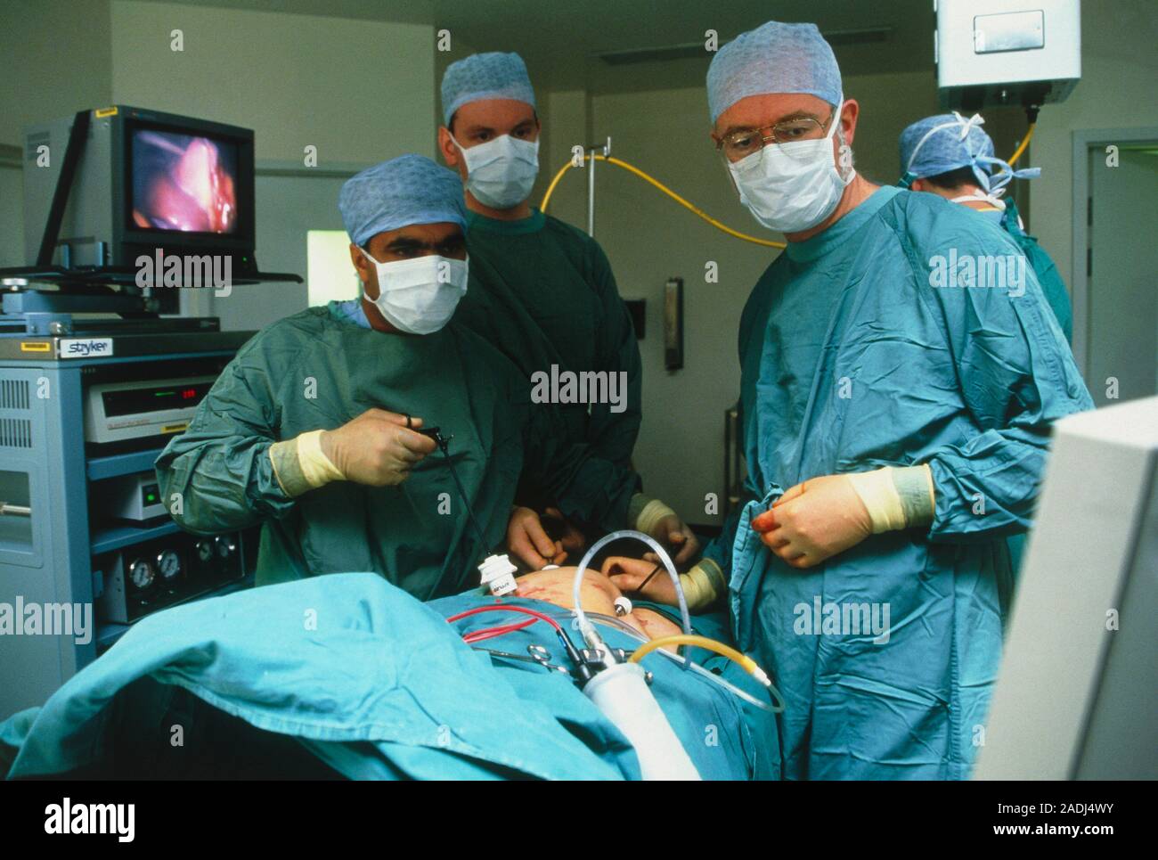 Laparoscopy. View of surgeons using laparoscopes (three at lower centre