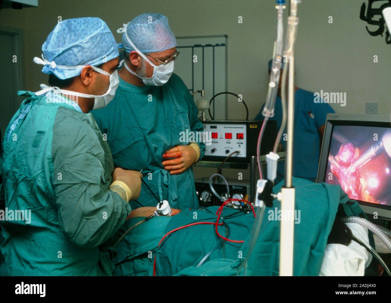 Laparoscopy. View of surgeons using a laparoscope (lower left) during