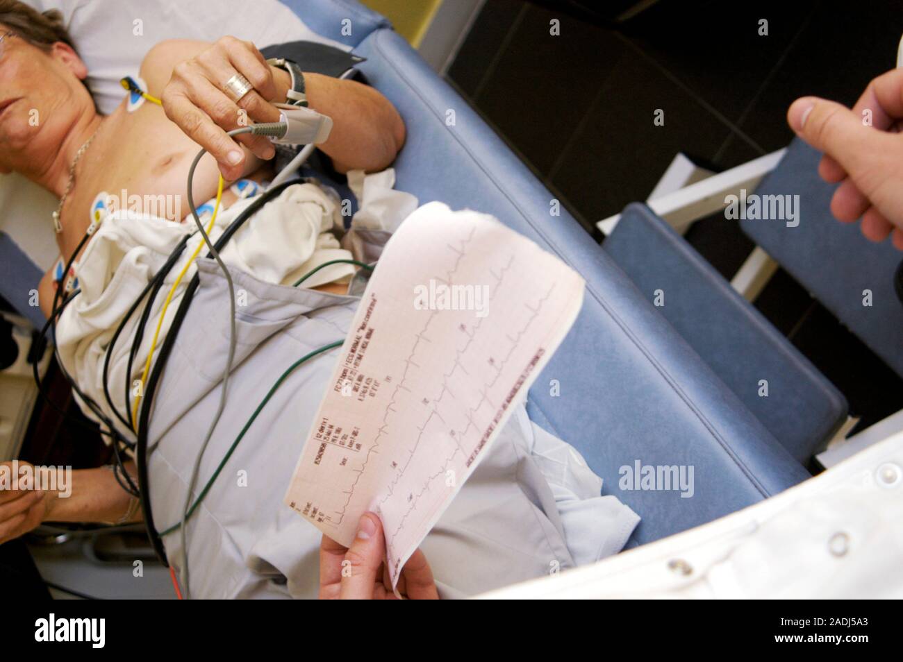 Electrocardiography. Female heart attack patient undergoing an