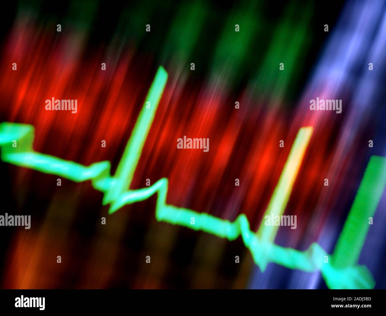 ECG. Computer artwork of an electrocardiogram (ECG) showing a normal ...