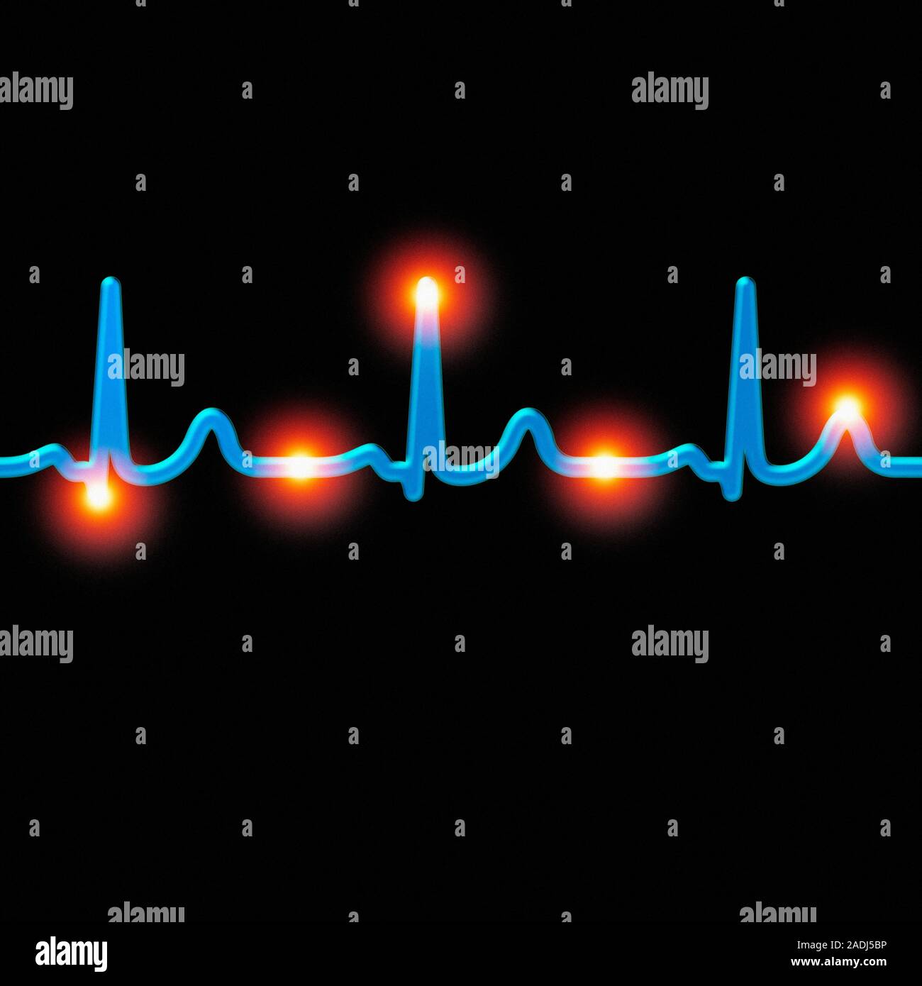 Electrocardiogram (ECG) of a normal heart rate, computer artwork. An ...