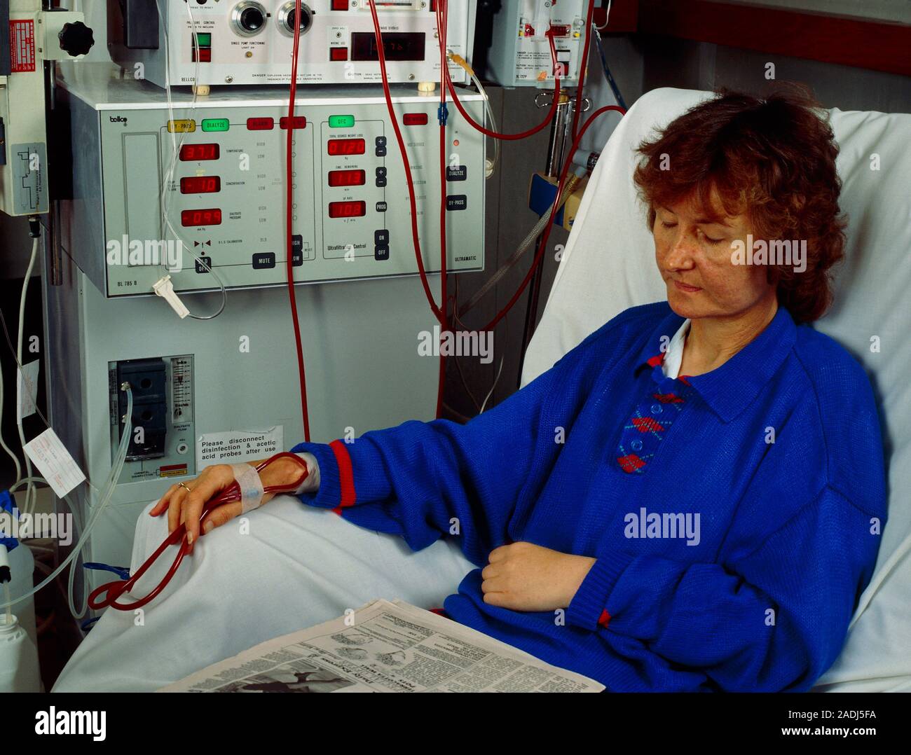 Female patient using a kidney machine to undergo renal dialysis. A