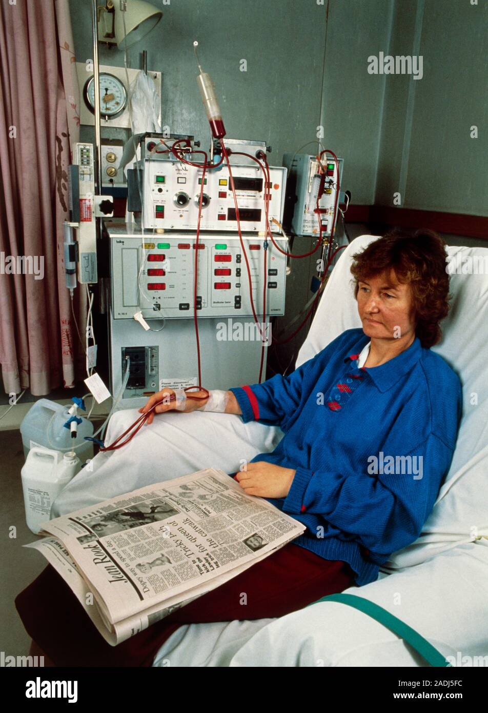Female patient using a kidney machine to undergo renal dialysis. A