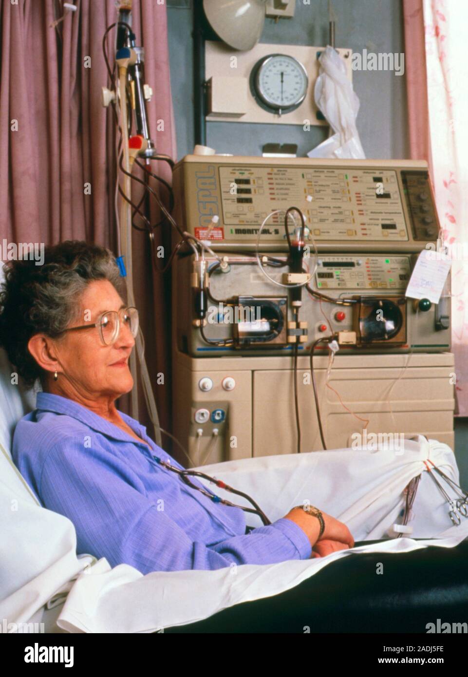 Female patient using a kidney machine to undergo renal dialysis. A