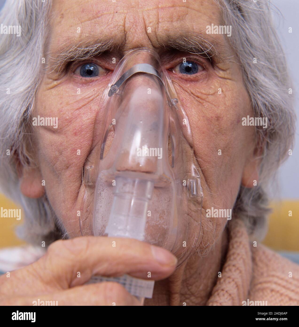 Oxygen therapy. 80yearold woman receiving extra oxygen to help her