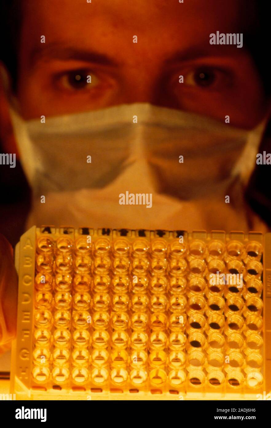 AIDS test technician examining wells in an ELISA (Enzyme Linked