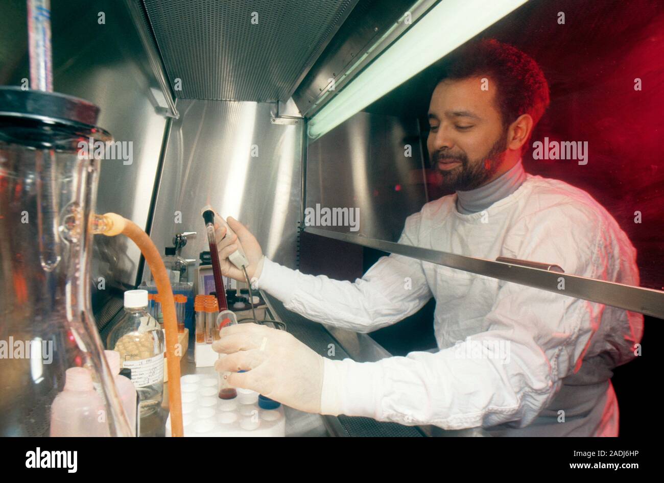 AIDS research. Male scientist pipettes a blood sample during AIDS