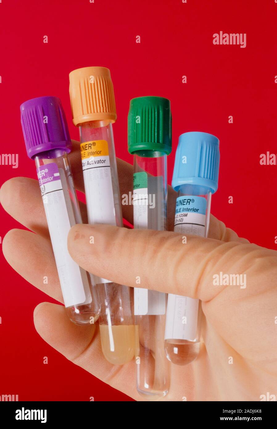 Blood sample bottles. Gloved hand holding an assortment of vacutainer