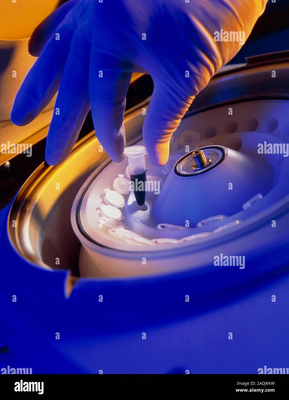 Blood centrifuge. Gloved hand loading a blood sample in a microtube