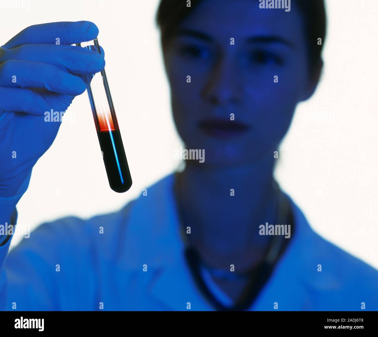 Blood analysis. Technician holding a blood sample in a test tube before analysis Stock Photo Alamy