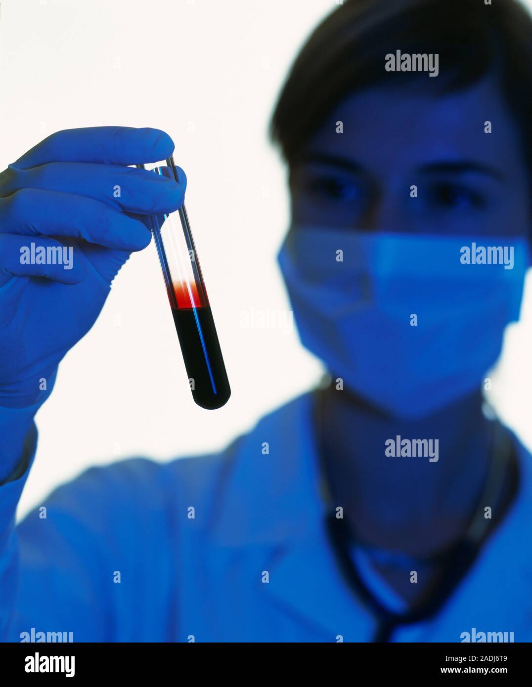 Blood analysis. Technician holding a blood sample in a test tube before ...
