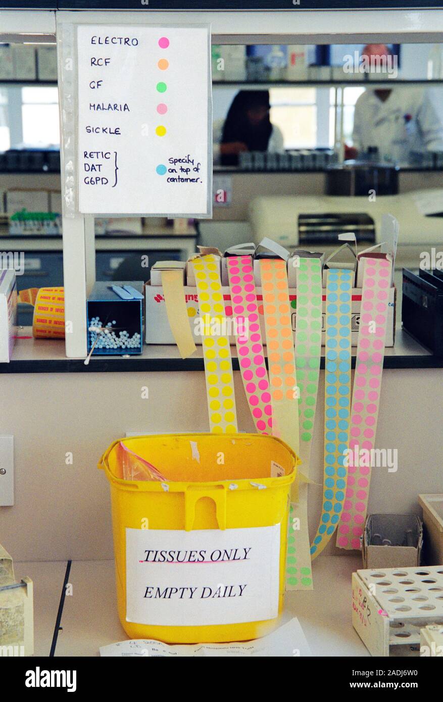 Blood testing laboratory. Coloured labels used to identify tests ...