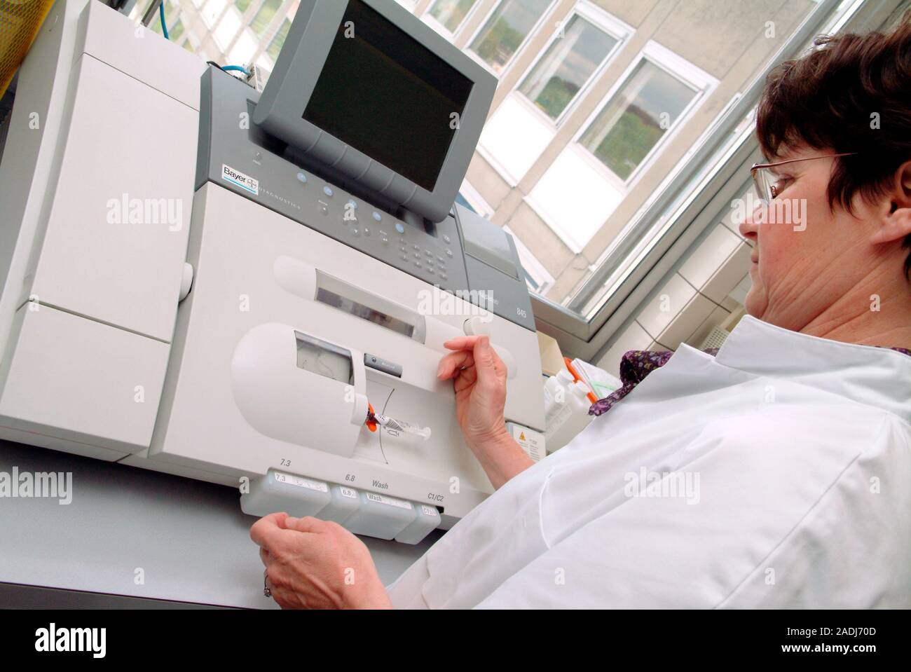 Blood testing. Medical laboratory worker using a blood gas analyser to
