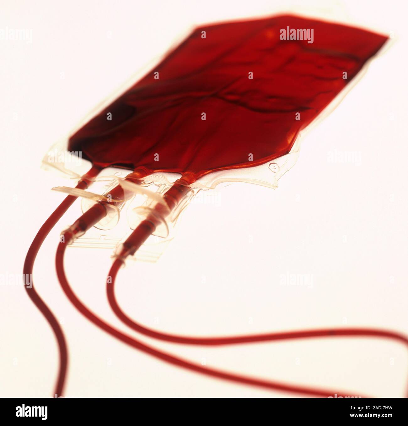 Full blood bag. Bag of blood to be used for a blood transfusion. The