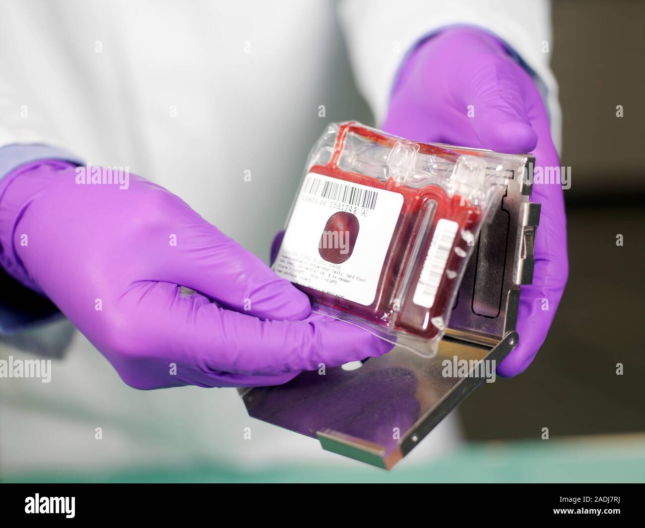 MODEL RELEASED. Umbilical cord blood stem cells. Technician holding
