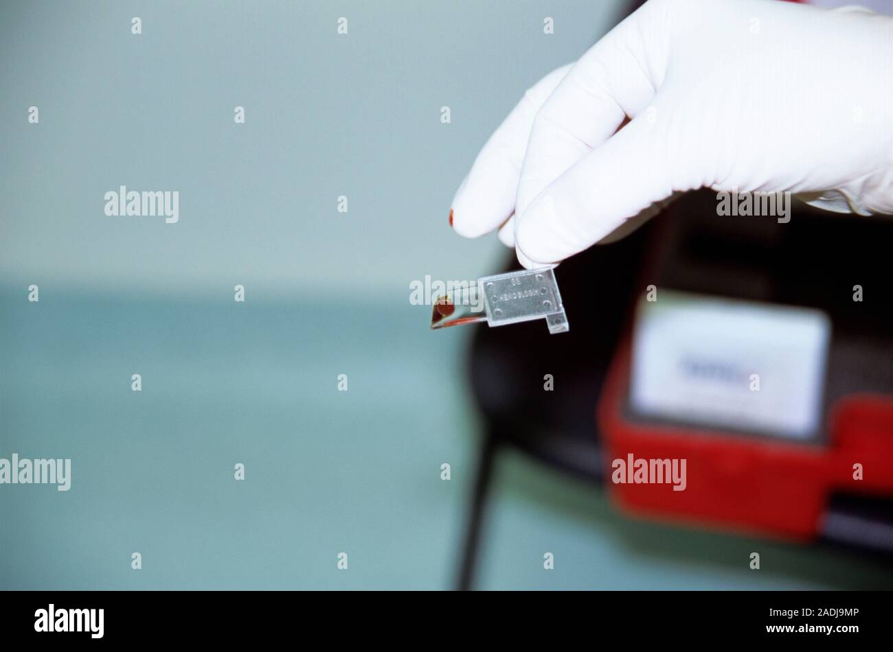 Surgical blood test. Image 1 of 2. Surgeon's hand holding a