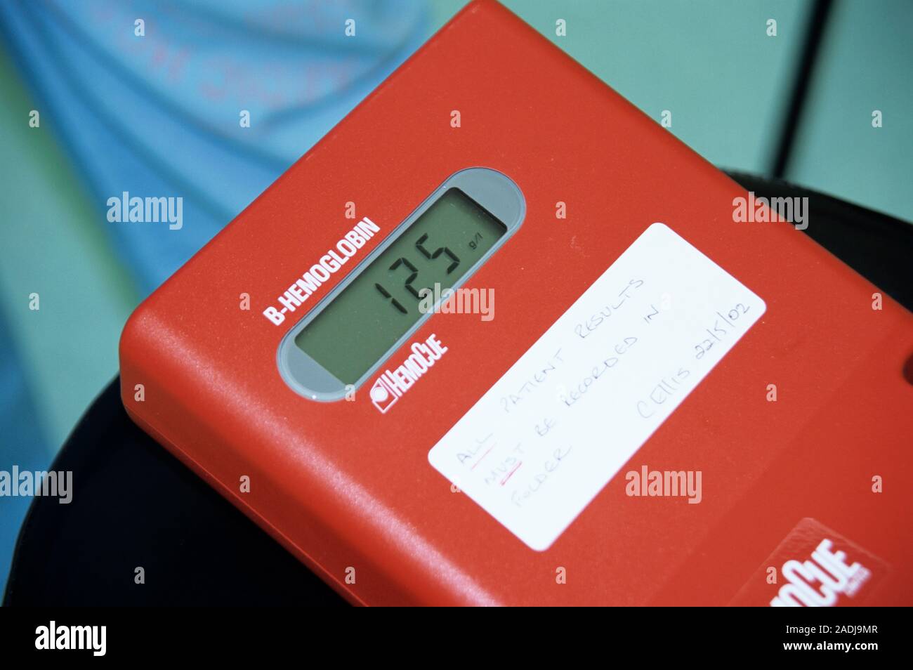 Surgical blood test. Image 2 of 2. Display of a blood testing machine