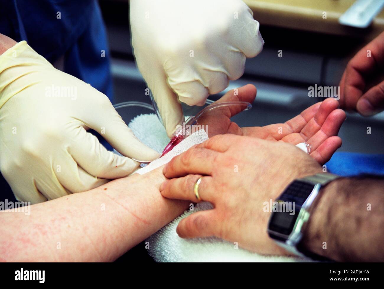 Set Sample Line Anesthesia Anaesthesia. Line being placed into the wrist of a patient to ...
