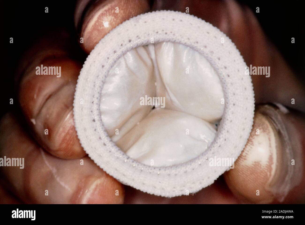 A completed artificial heart valve made from a natural substance called