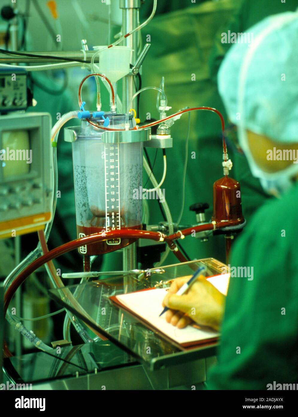 Heartlung machine. Theatre assistant notes the reading of a heartlung