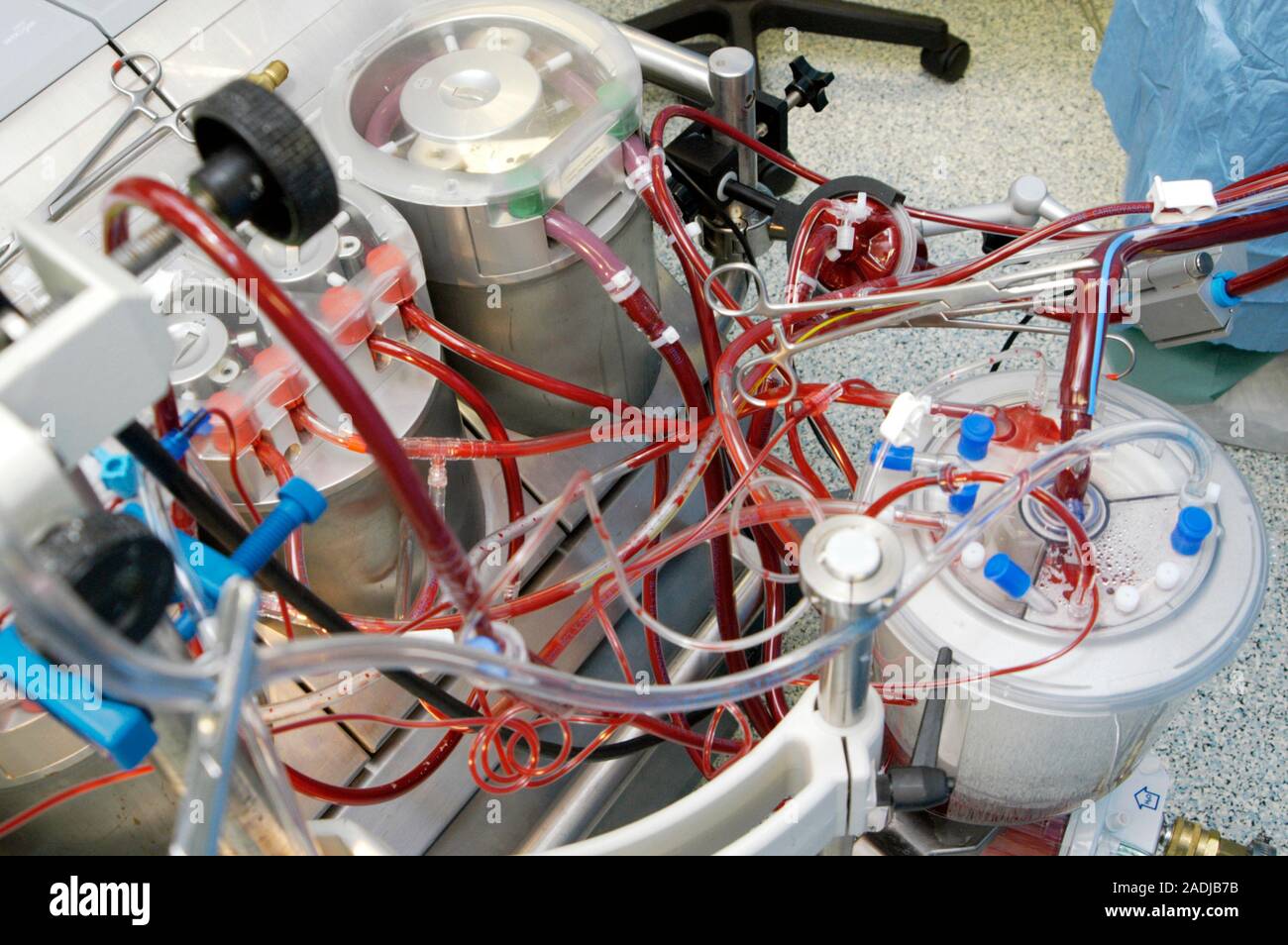 Heart-lung machine. Image 12 of 24 Heart-lung machine being used during ...