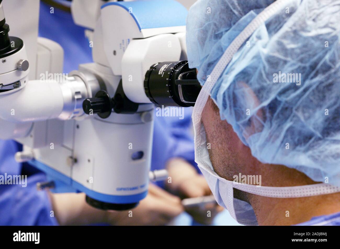 MODEL RELEASED. Cataract surgery. Surgeon using a microscope during