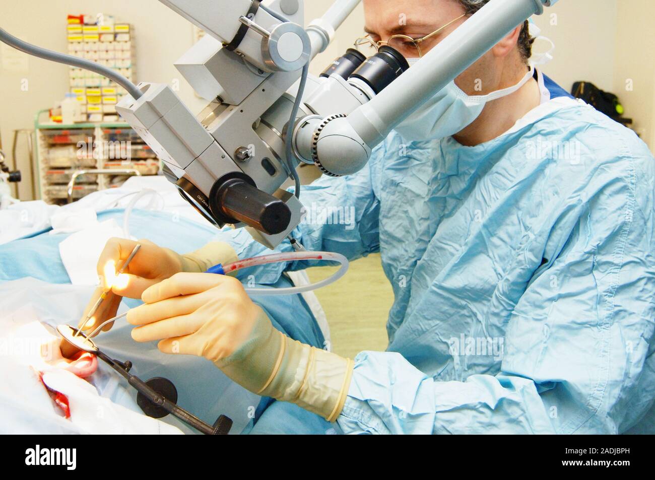 MODEL RELEASED. Eardrum surgery. Image 6 of 6. Surgeon repairing a