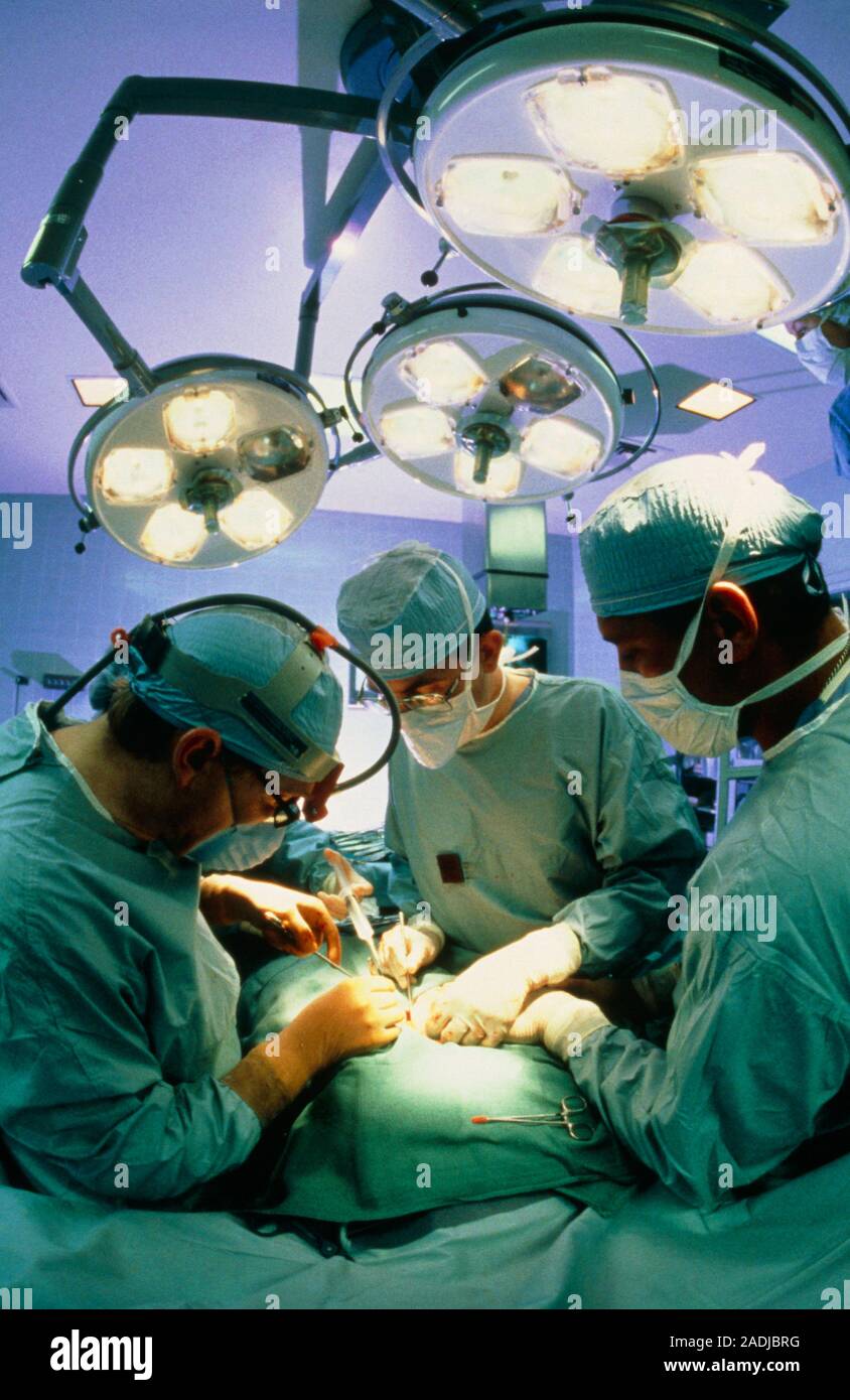 Реципиент трансплантация. Аллотрансплантации почки. Трансплантация печени. Трансплантация органов фото.