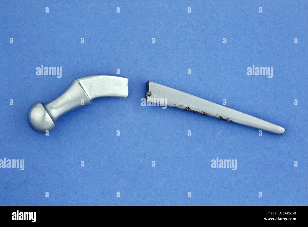 Broken hip joint. A hip prosthesis with a broken shaft. This metal