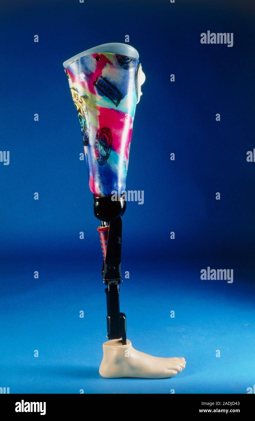 Leg prosthesis. Side view of a prosthetic (artificial) leg with reflex