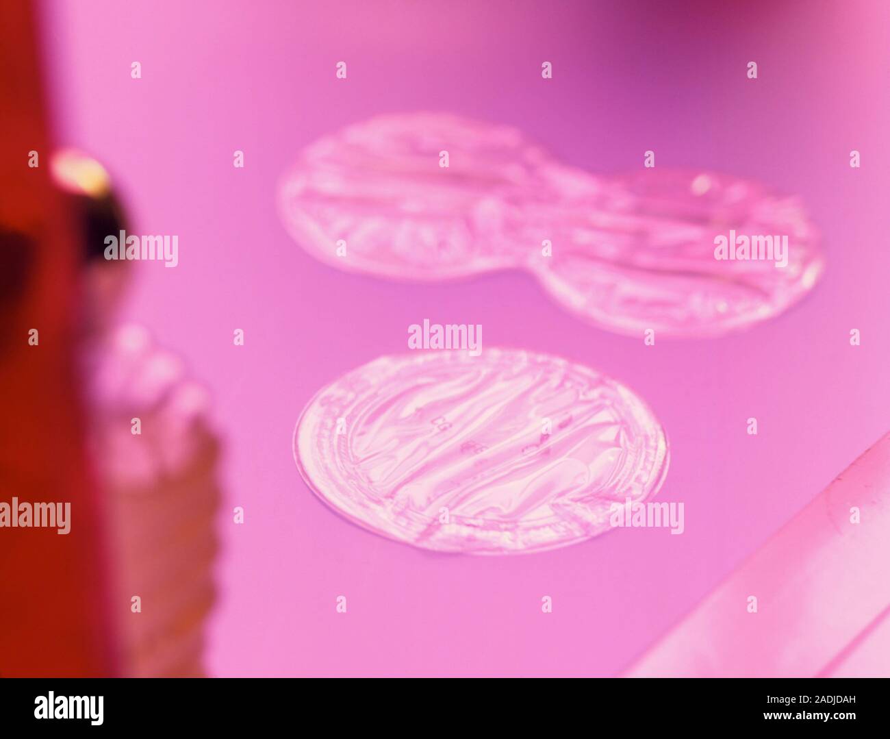 Hormone replacement therapy. Two patches used in hormone replacement