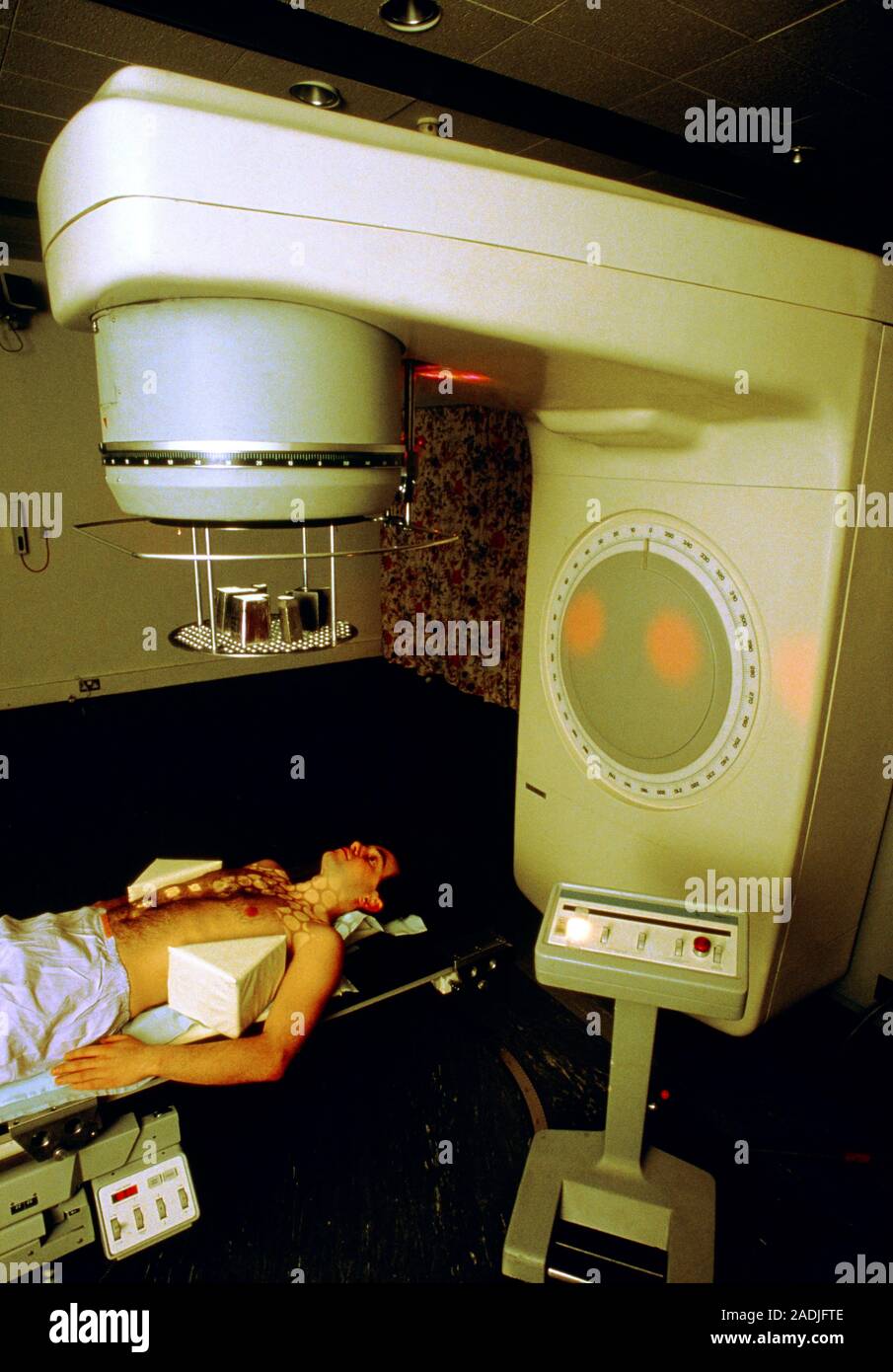 Person undergoing radiotherapy on a linear accelerator to treat Hodgkin ...
