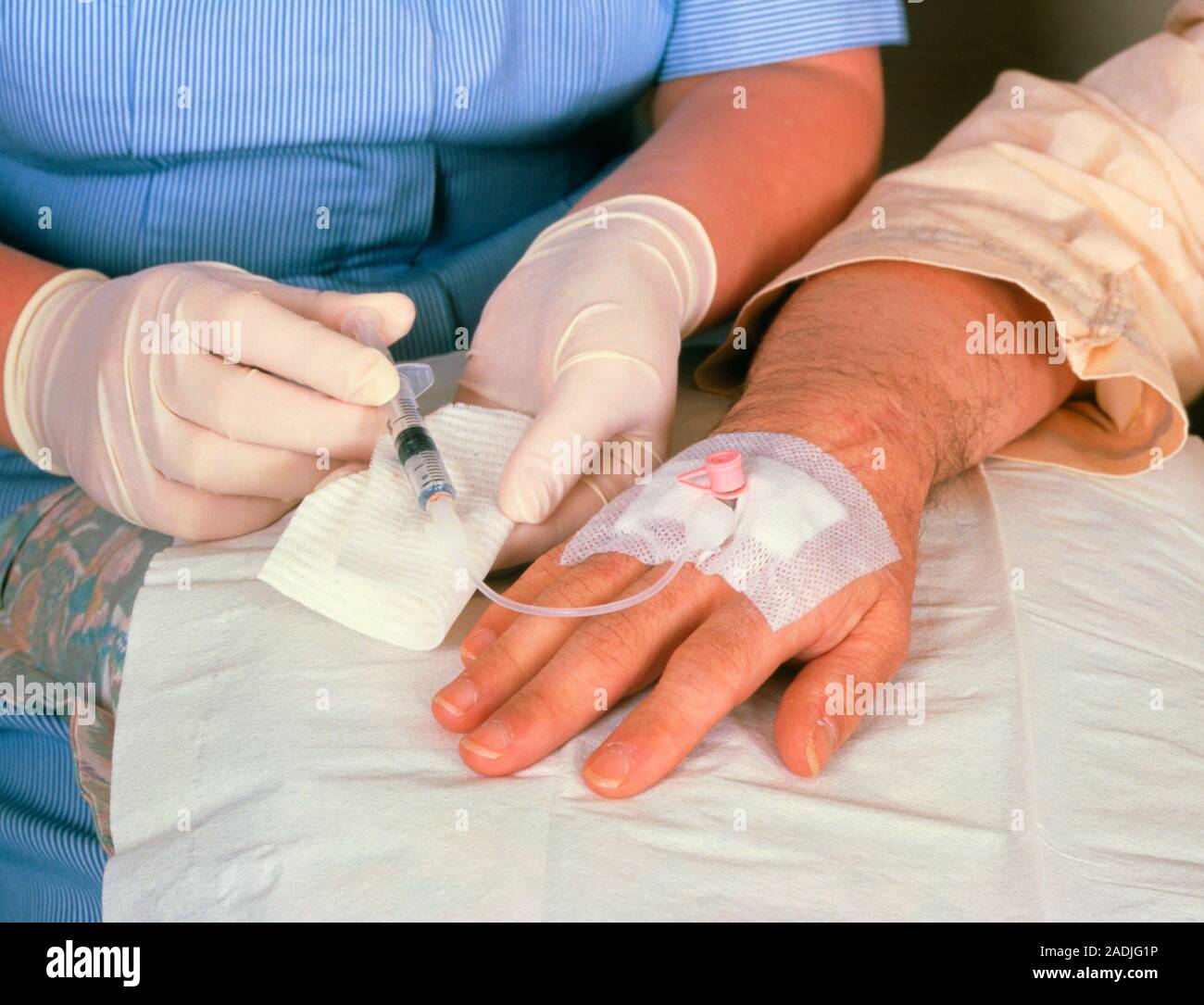 Chemotherapy. Drug injected into a catheter in a man's hand, during