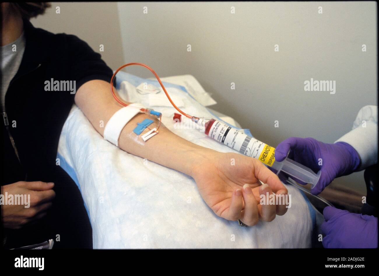 Cancer chemotherapy. Female patient receiving an intravenous dose of ...