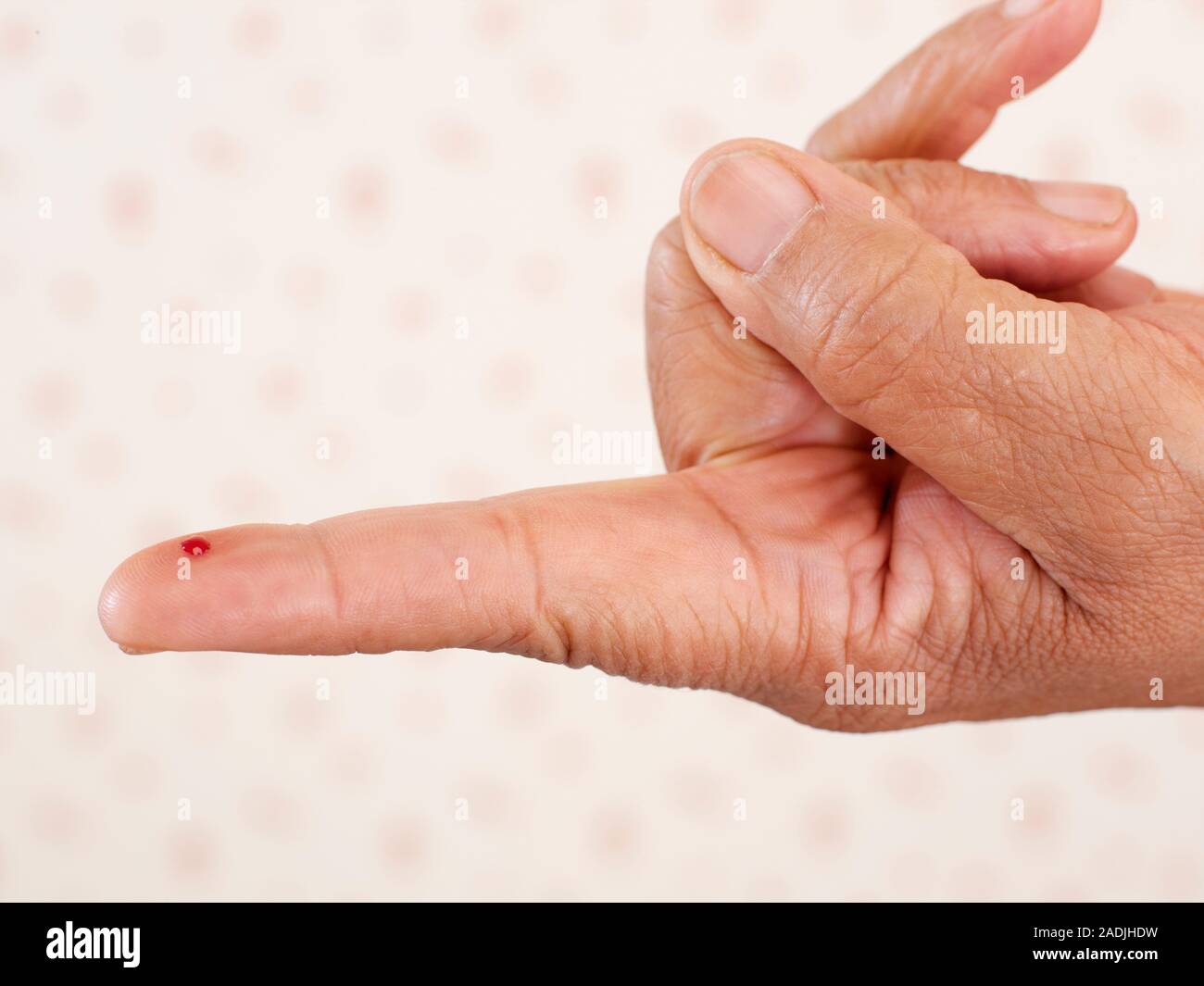 MODEL RELEASED. Blood gluscose test. Spot of blood emerging from a