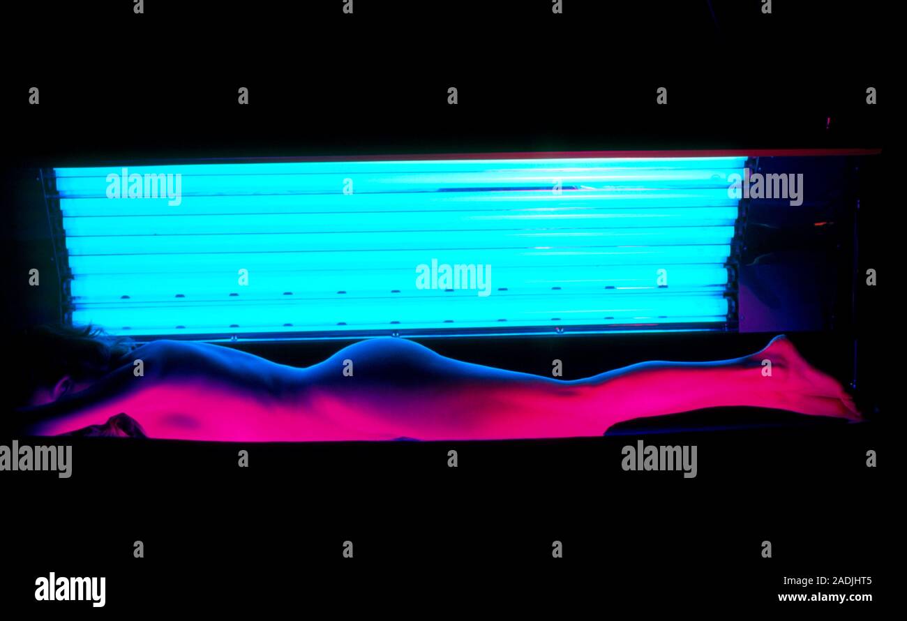 Woman sunbathing under an array (a sunbed") of ultraviolet light tubes