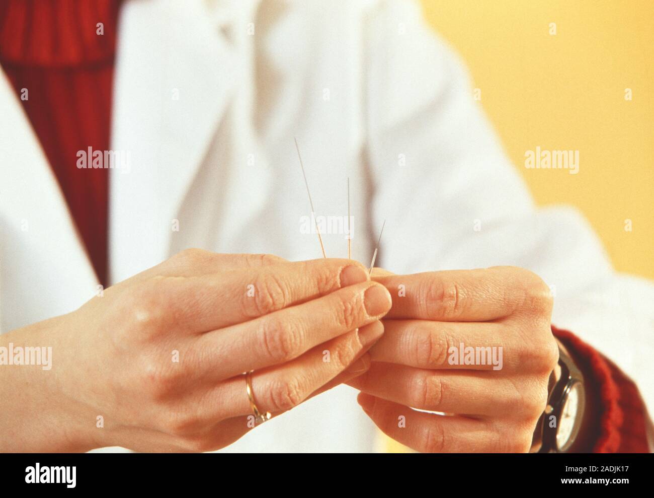 Acupuncture. Acupuncturist holding acupuncture needles of different