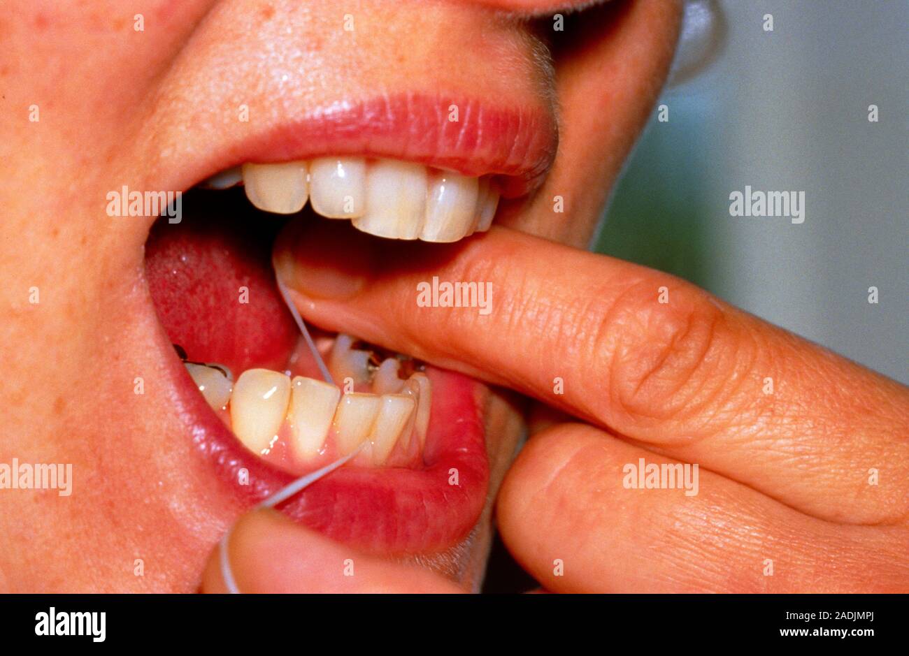 Young woman using dental floss (a cotton thread which may be waxed or  unwaxed) to clean particles of food from around her teeth & gingival  crevices (t Stock Photo - Alamy