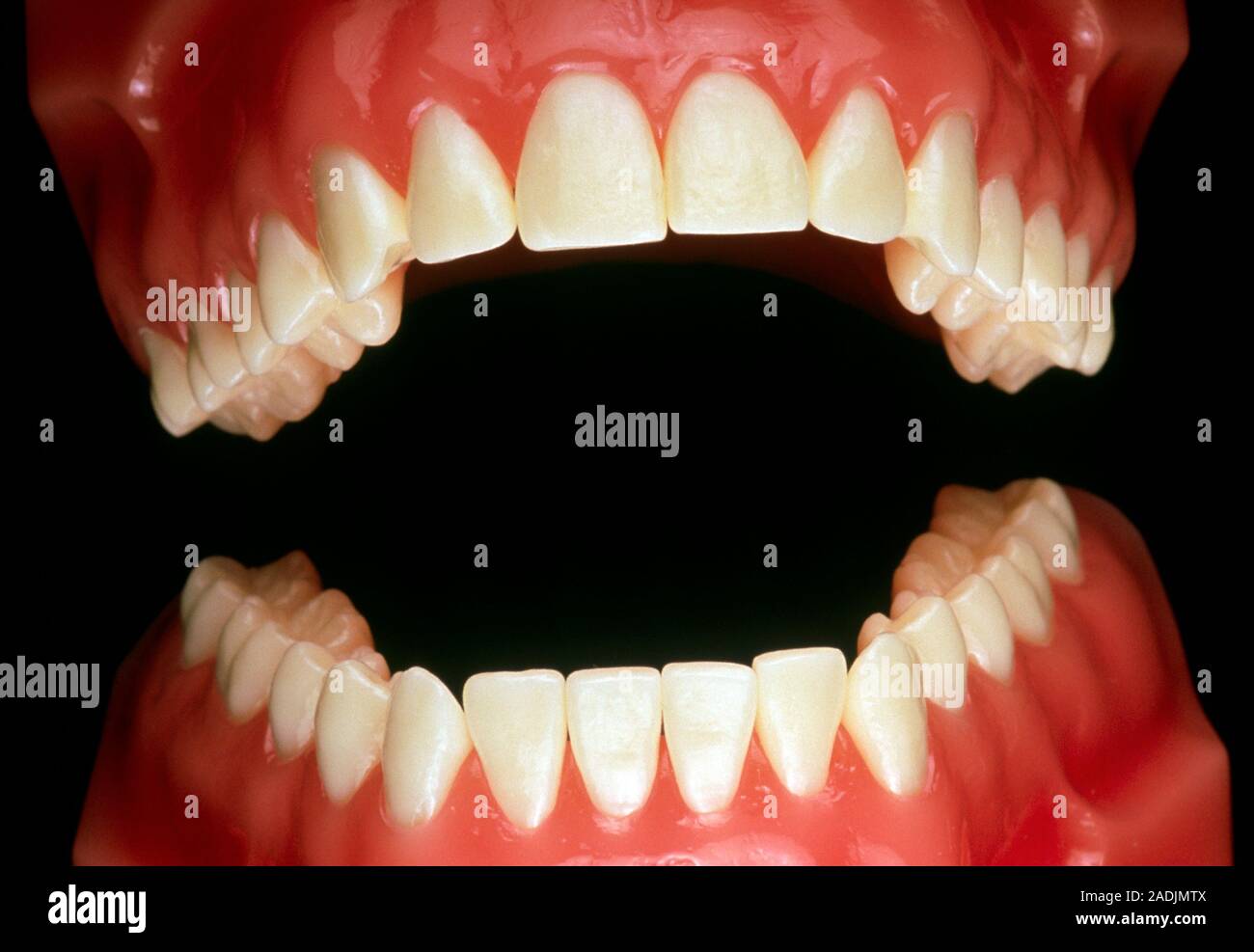 False teeth. Dental model of a pair of open false teeth seen from the ...