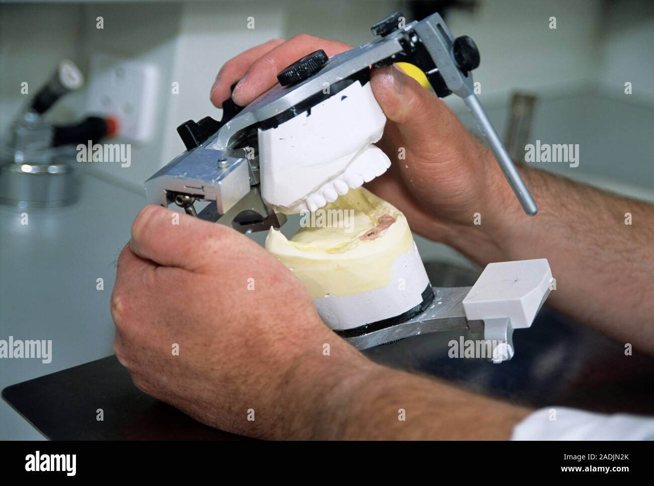 Dental model. Technician removing a plaster dental model from its mould