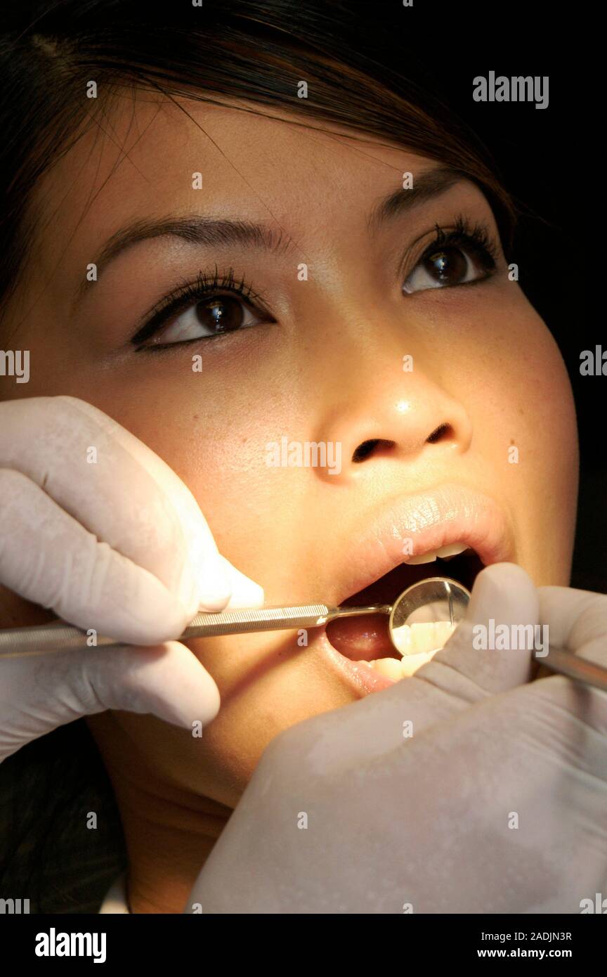 MODEL RELEASED. Plaque removal. Dentist scraping a female patient's teeth Stock Photo Alamy