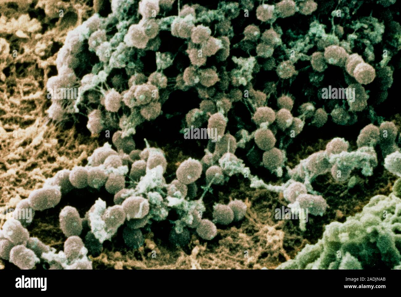 False colour scanning electron micrograph (SEM) of colonies of an ...