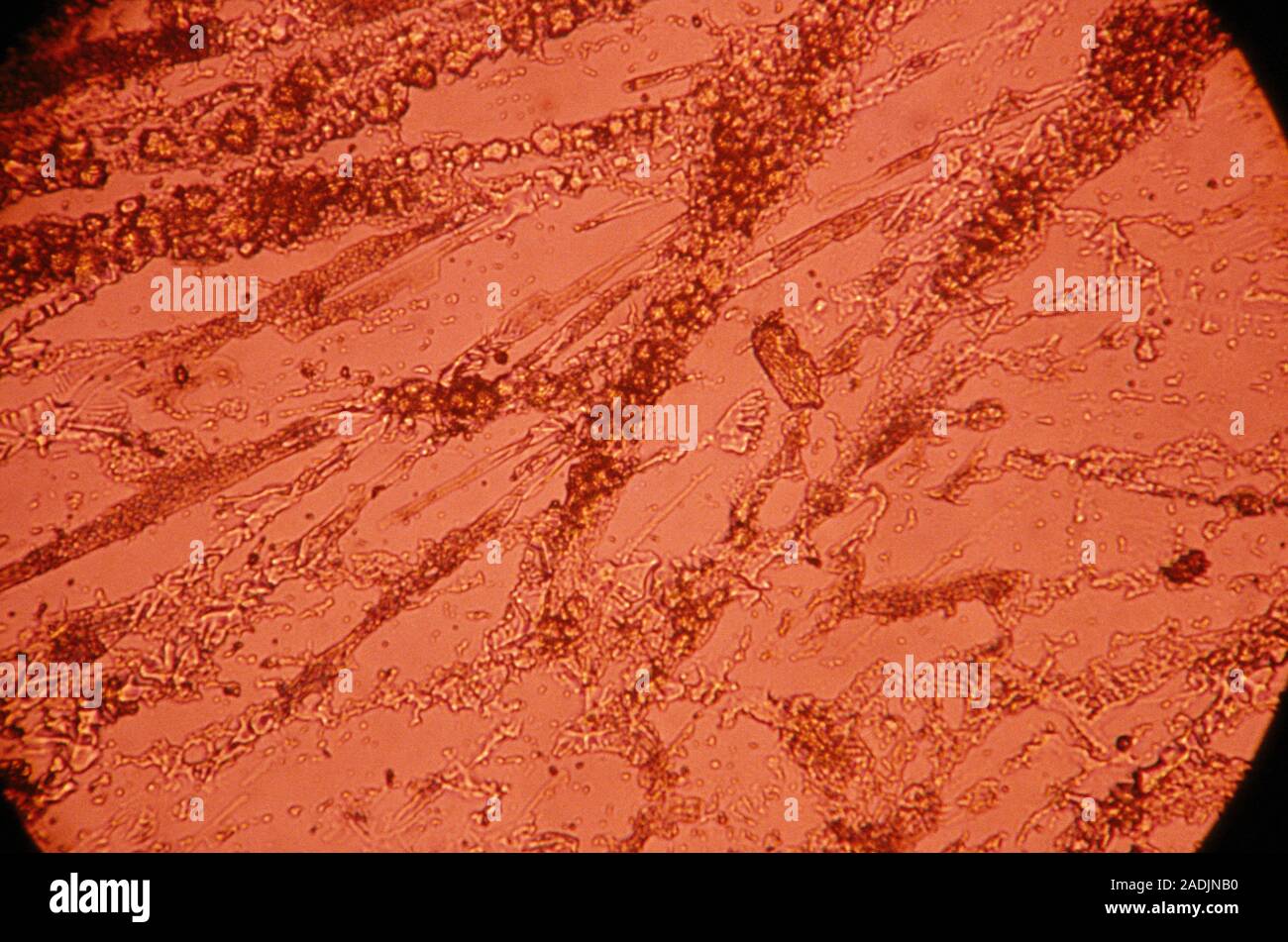 Dental plaque. Light micrograph of the saliva, bacteria and food debris that forms on teeth and