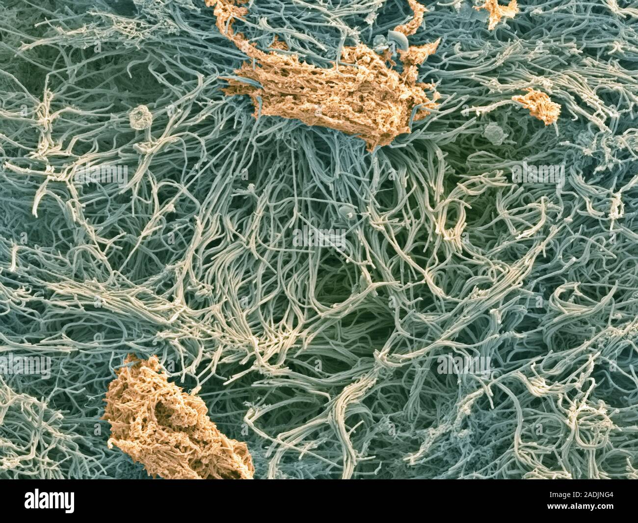 Dental plaque, coloured scanning electron micrograph (SEM). Plaque