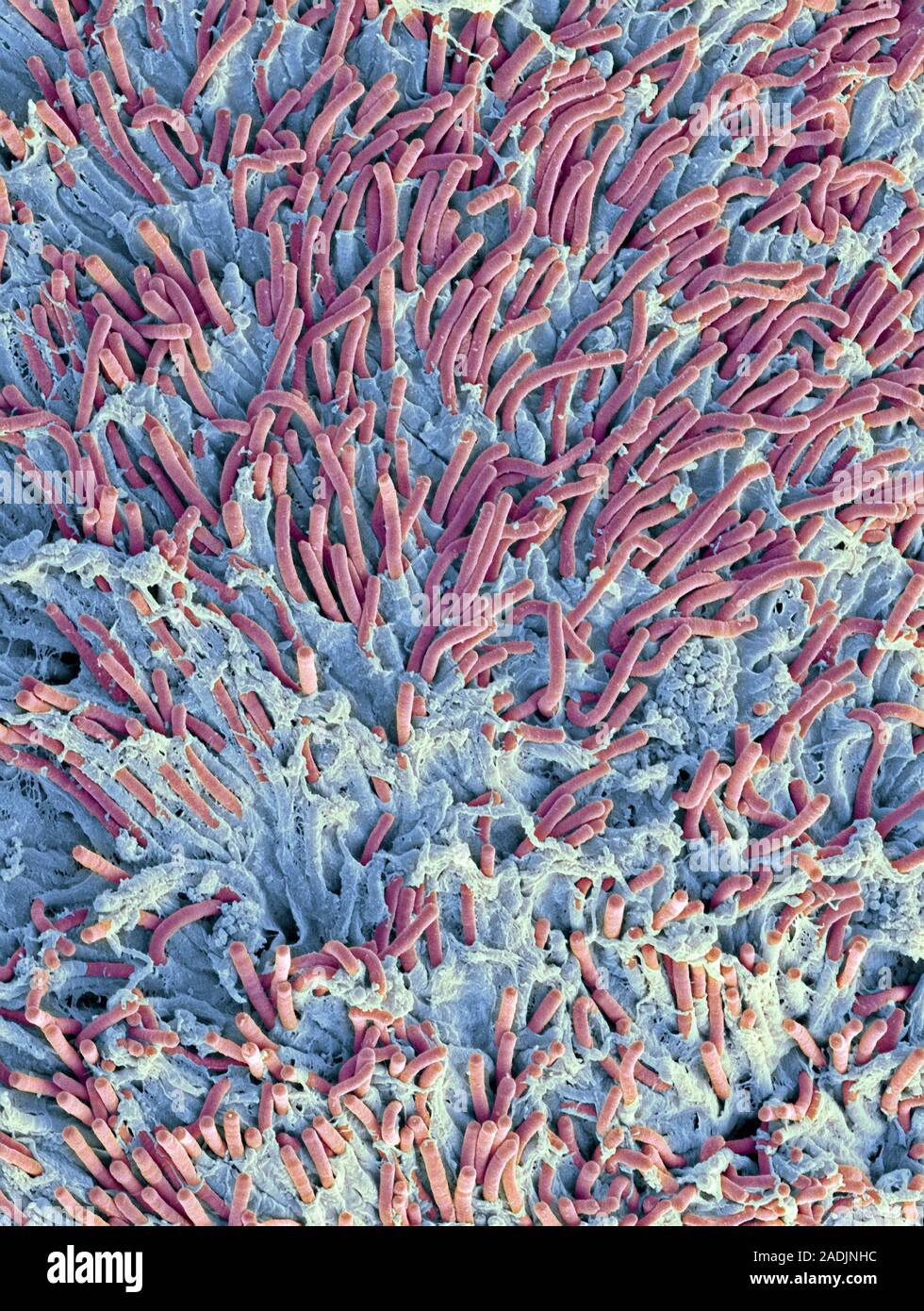 Dental plaque, coloured scanning electron micrograph (SEM). Plaque