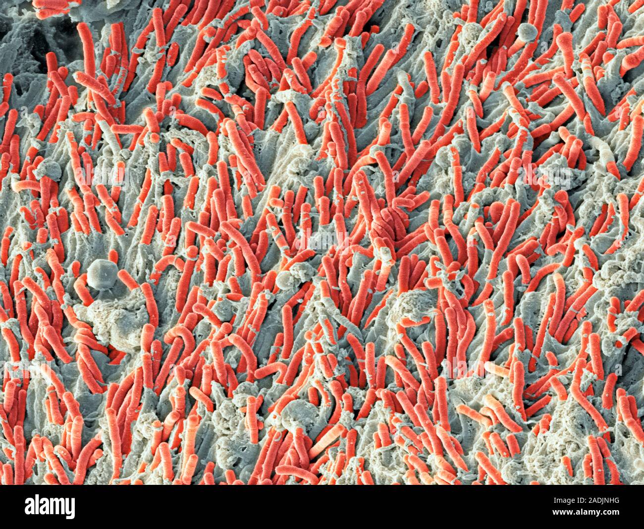 Dental plaque. Coloured scanning electron micrograph (SEM) of plaque
