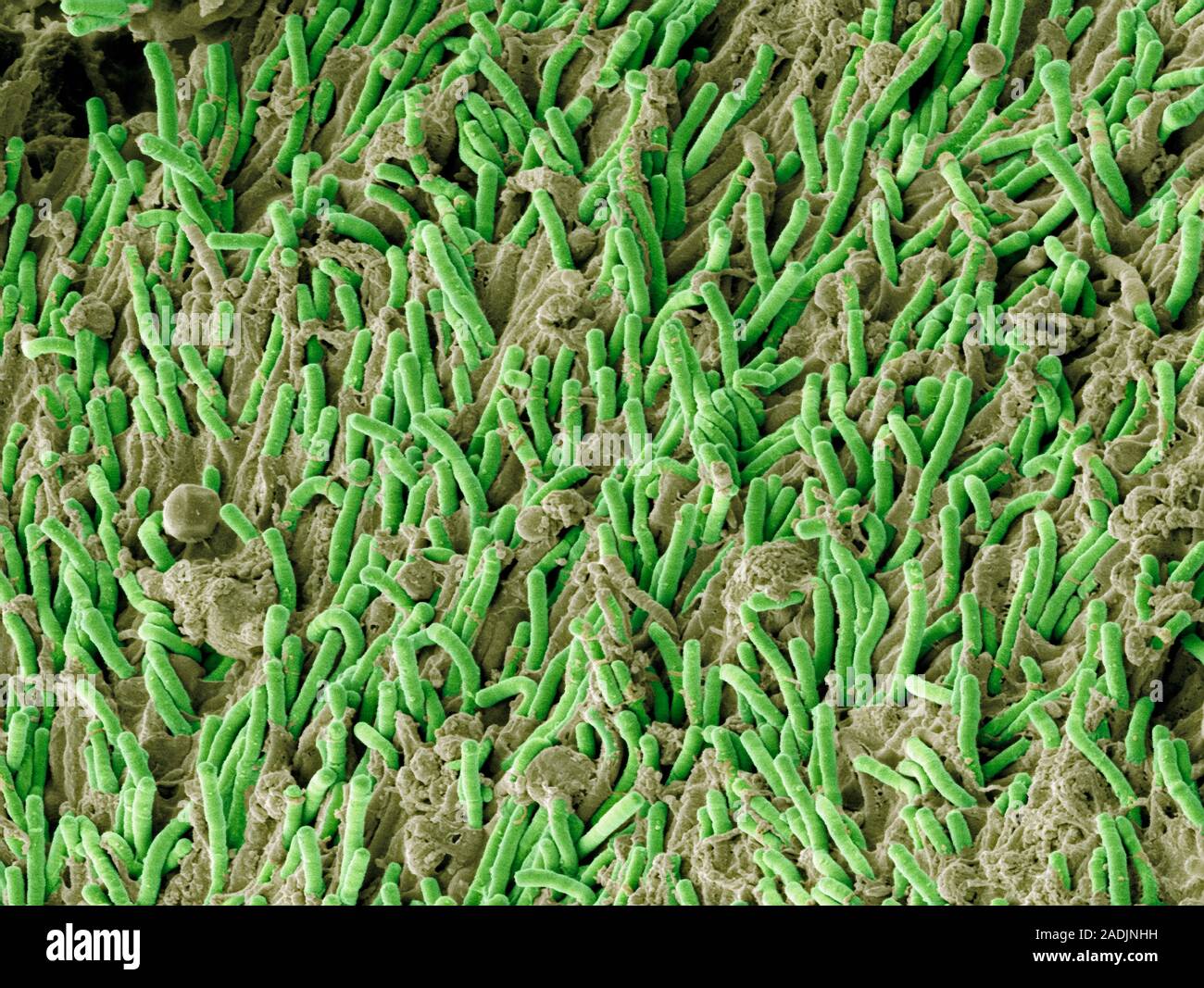 Dental plaque. Coloured scanning electron micrograph (SEM) of plaque