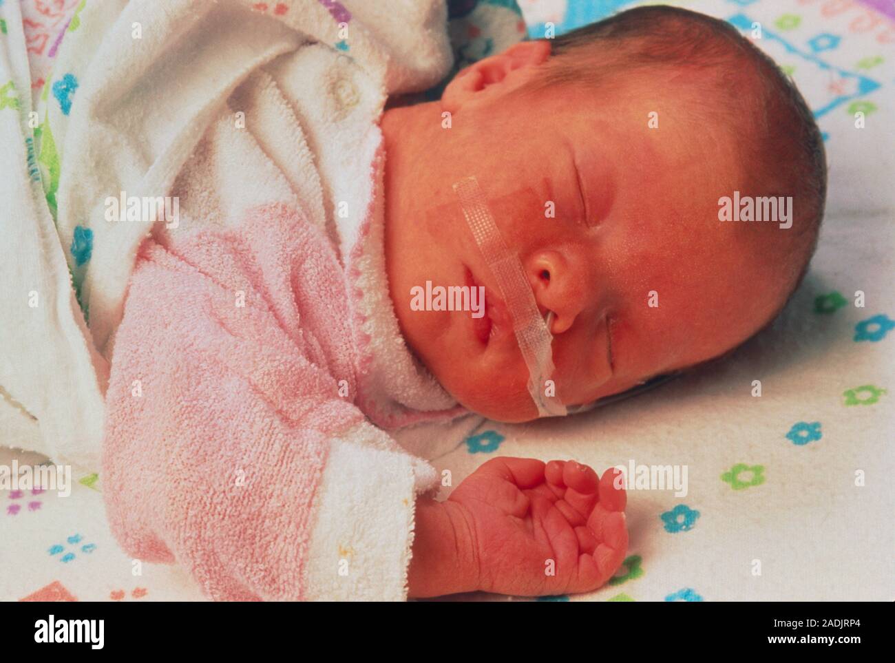 Baby receives oxygen. Newborn baby in a hospital baby unit undergoes ...