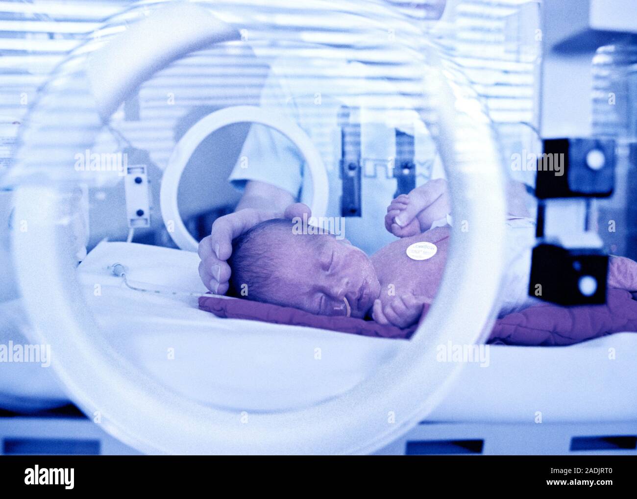 Premature baby in an incubator. Babies born before 37 weeks of